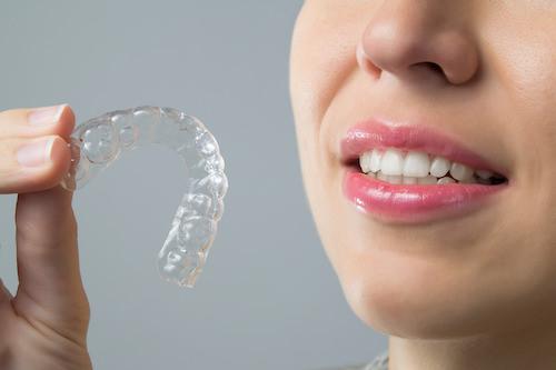 invisalign clear aligners narre warren