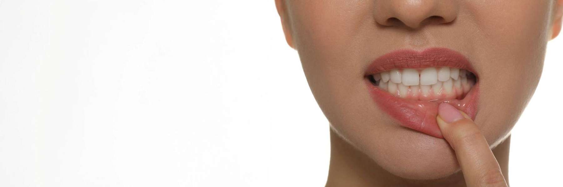 girl with receding gums in narre warren