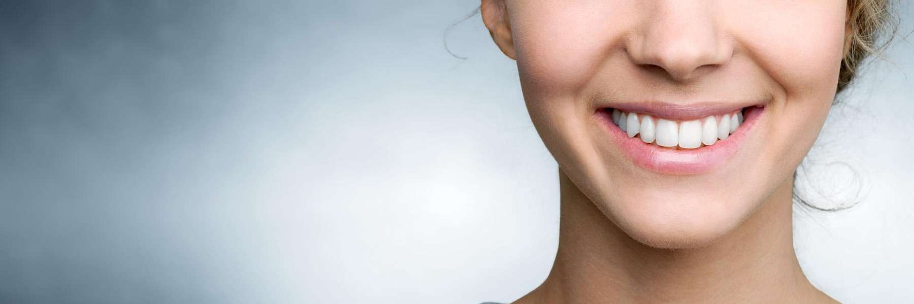 girl with teeth whitening results in narre warren